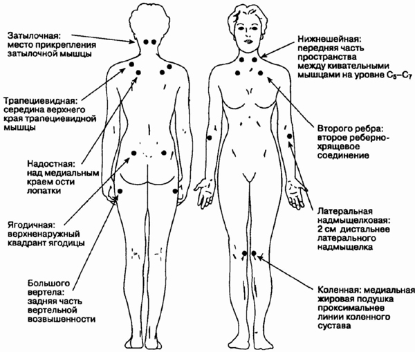 схема точки на теле человека схема