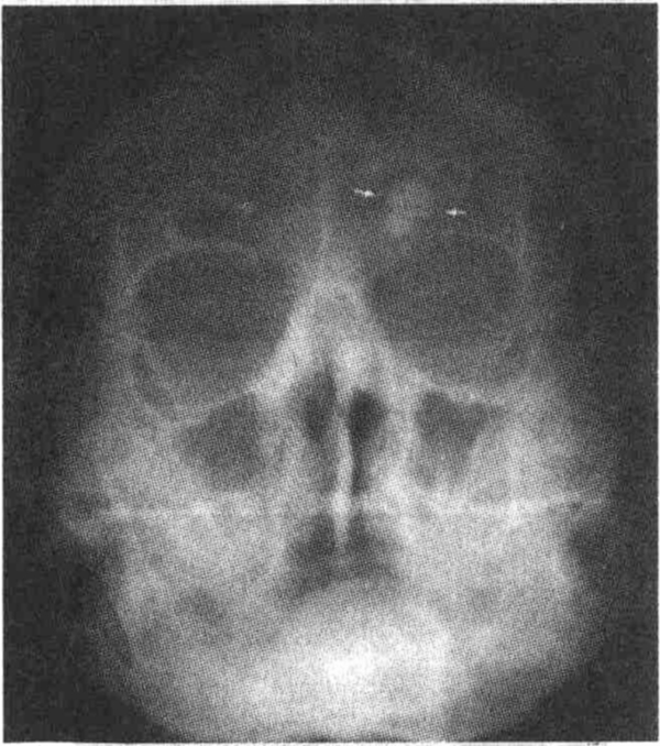 head13-4.jpg
