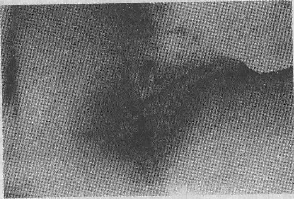 tmp8265-2.jpg